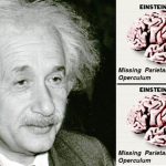 Misteri Otak Einstein: Penelitian, Kontroversi, dan Jejak Ilmiah Gila